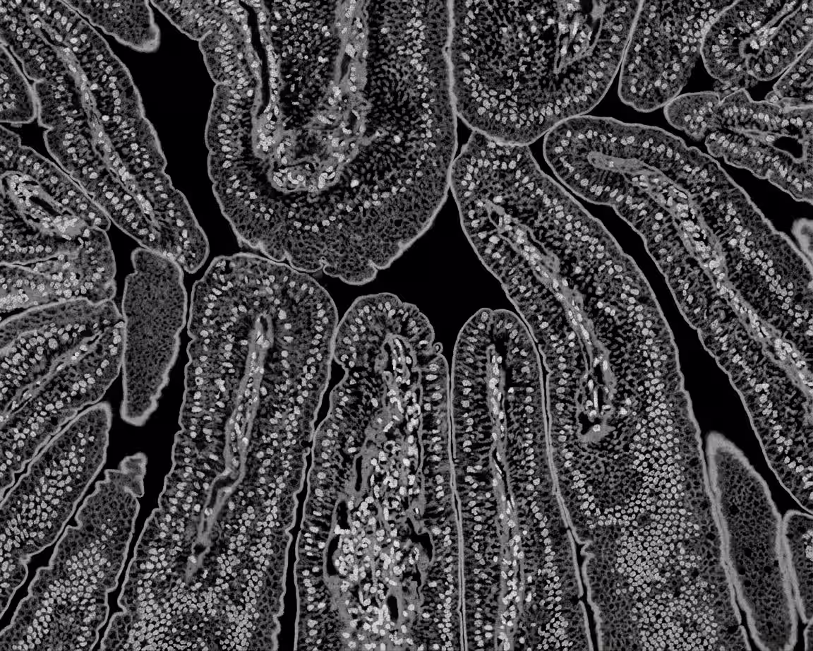 microbiome pattern